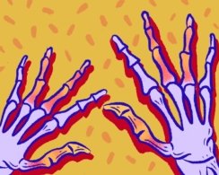 Что такое артрит и как его вылечить