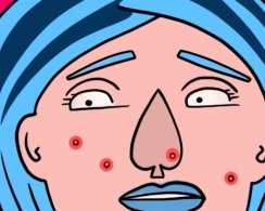 Личный опыт: как я вылечила прыщи