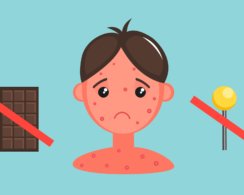 4 мифа о пищевой аллергии, которые почему-то ещё живы